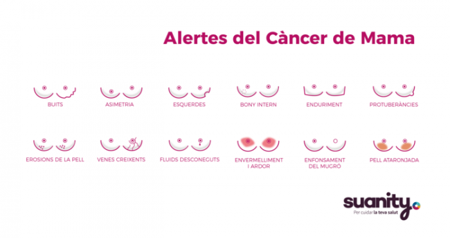 12 signes o símptomes del Càncer de Mama i com saber detectar-los.