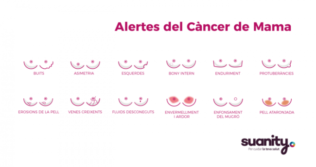 12 signos o síntomas del Cáncer de Mama y cómo saber detectarlos.